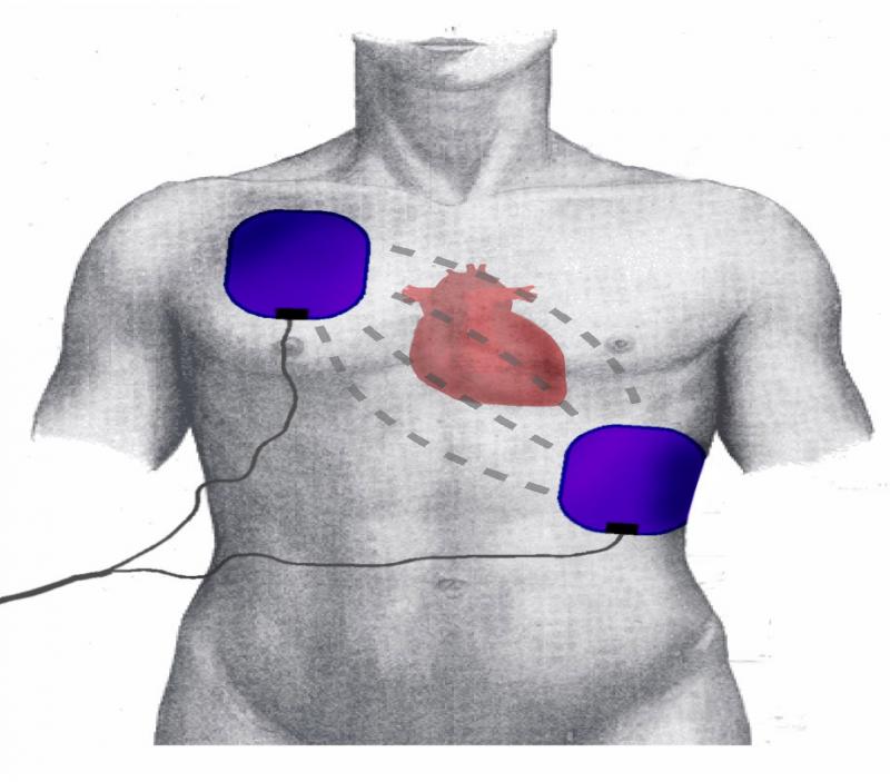 obbligo di presenza dei defibrillatori